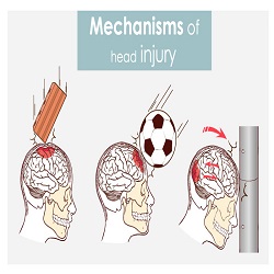 Head Injury