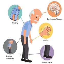 Parkinson's Disease